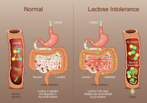 How I Fixed My Lactose Intolerance (To a Large Extent)